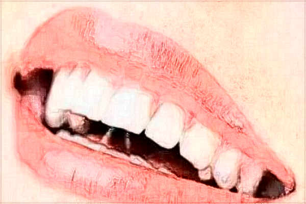 延邊醫(yī)院牙齒矯正價(jià)格多少?做的怎么樣