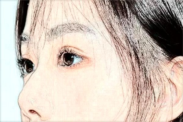 沈陽盛京醫(yī)院吸脂去眼袋做的怎么樣_好的醫(yī)生有誰