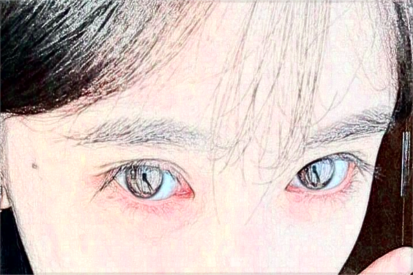 2024無錫市第一人民醫(yī)院激光去紋眉做的可以嗎？