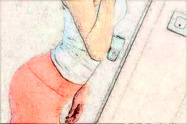 大連醫(yī)科大學(xué)附屬第一醫(yī)院吸脂做的好嗎?整形日記分享