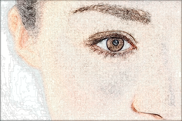 2024青島市立醫(yī)院雙眼皮多少錢?雙眼皮有幾種款式