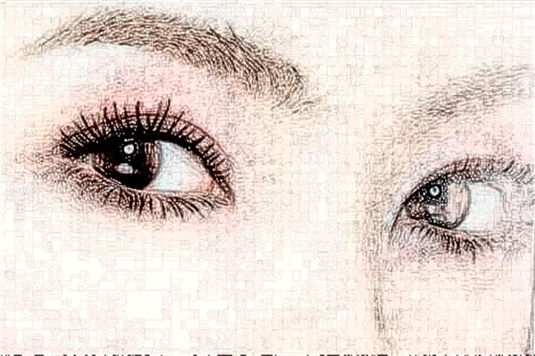 蘭州大學(xué)第二醫(yī)院做近視手術(shù)好么?近視手術(shù)多少度能做