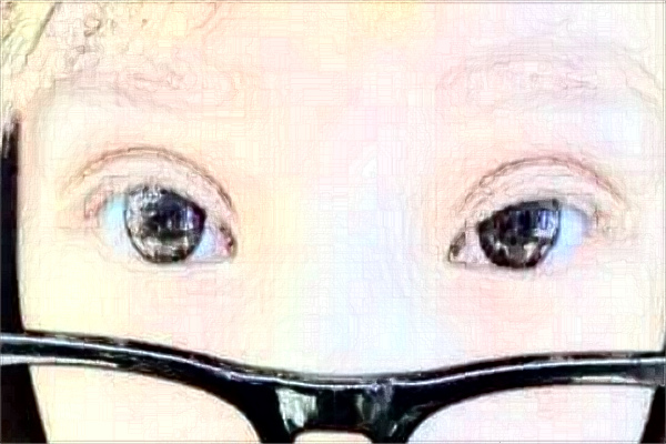 2024大連大學(xué)附屬新華醫(yī)院半飛秒怎么樣_案例_醫(yī)生名單