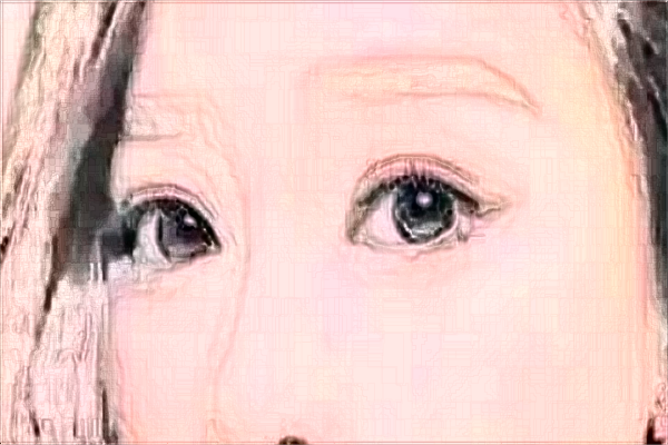 2024大連大學(xué)附屬新華醫(yī)院半飛秒怎么樣_案例_醫(yī)生名單