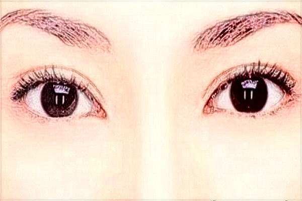 2024延邊醫(yī)院割雙眼皮醫(yī)生排名_口碑+價格