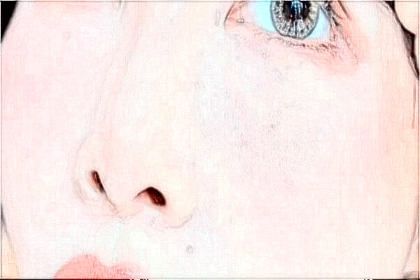 安徽省立醫(yī)院熱瑪吉做的好嗎?整形日記分享