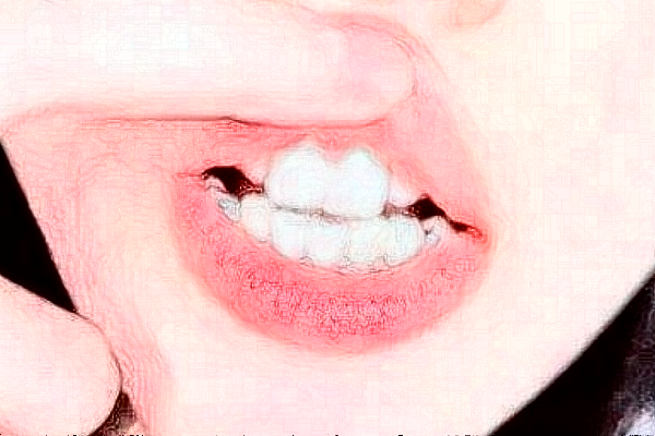 蘇北人民醫(yī)院牙齒美白價(jià)目表_口碑怎么樣