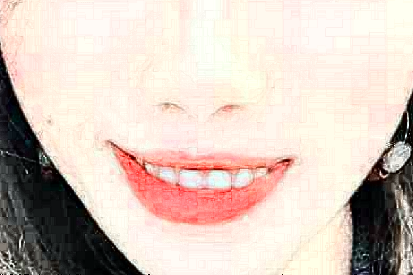 天津醫(yī)科大學總醫(yī)院口腔科畸形矯治需要多少錢?醫(yī)生推薦