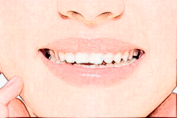 鎮(zhèn)江江濱醫(yī)院義齒修復(fù)價目表(價格表)怎么樣