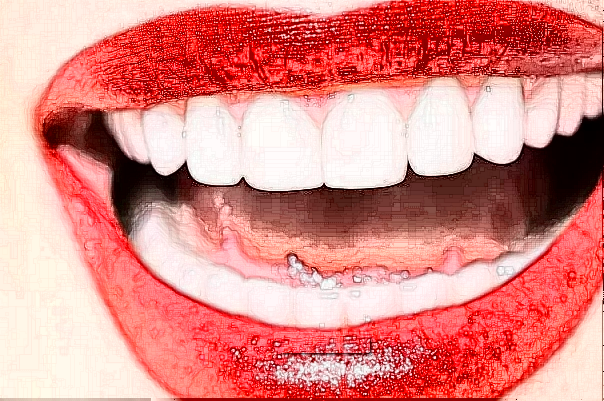 鎮(zhèn)江江濱醫(yī)院種植牙怎么樣?哪個(gè)醫(yī)生做的比較好