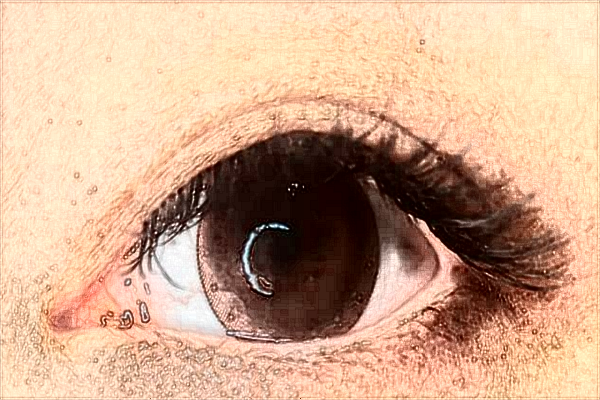 2024海口市人民醫(yī)院近視激光手術(shù)費(fèi)用?近視手術(shù)需要多久