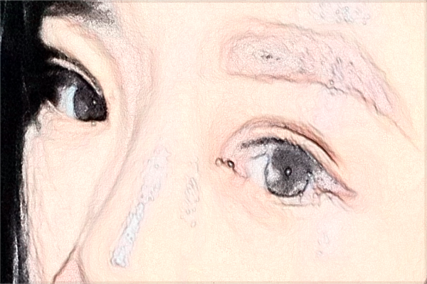 2024海口市人民醫(yī)院近視激光手術(shù)費(fèi)用?近視手術(shù)需要多久