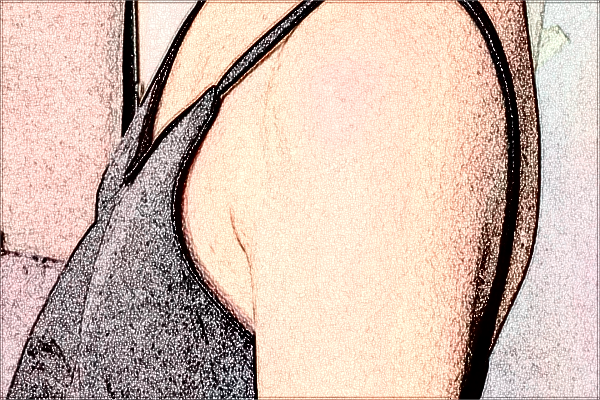 2024?？谑腥嗣襻t(yī)院洗紋身價格?洗紋身會不會留疤?