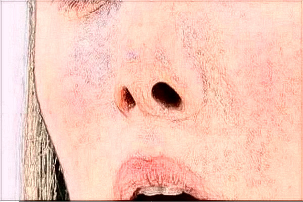 常德市第—人民醫(yī)院祛雀斑掛什么科?激光祛斑會(huì)不會(huì)反彈?