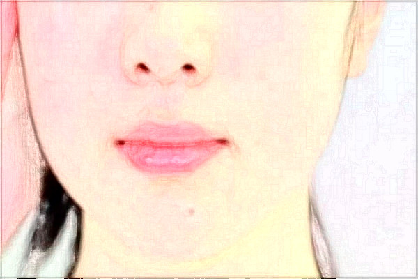 2024青島市立醫(yī)院激光祛斑要多少錢?激光祛斑好不好?