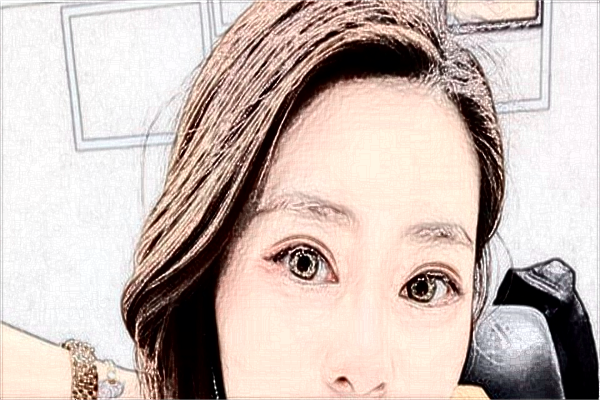 ?？谑腥嗣襻t(yī)院醫(yī)美怎么樣?醫(yī)美項(xiàng)目都有哪些