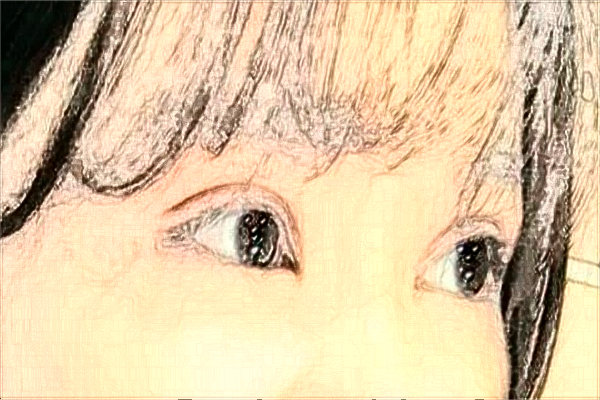 2024杭州市第一人民醫(yī)院埋線雙眼皮誰做得好_需要多少錢