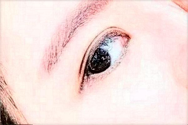 2024延邊醫(yī)院去除眼袋案例反饋，做過的都說不錯(cuò)