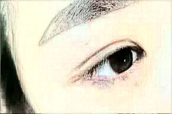 2024延邊醫(yī)院去除眼袋案例反饋，做過的都說不錯(cuò)