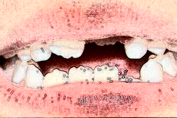 2024蘇州姑蘇美奧口腔烤瓷牙怎么樣_誰做得好