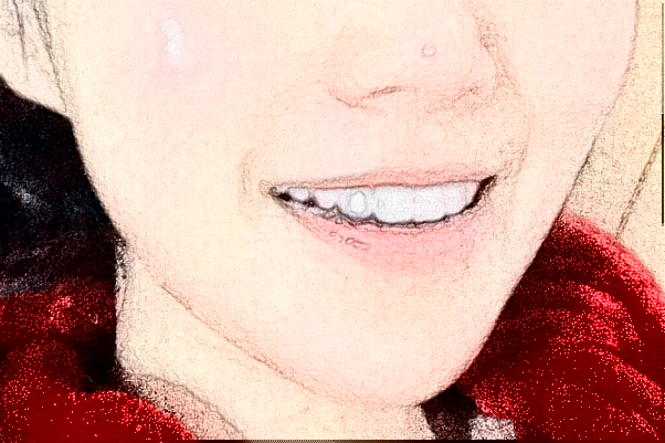 2024蘇州康美美容醫(yī)院鑲牙怎么樣_誰(shuí)做得好