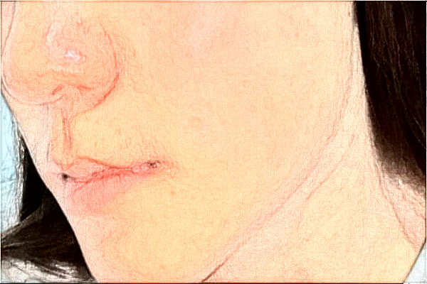 2024杭州市第一人民醫(yī)院熱瑪吉怎么樣_誰做得好