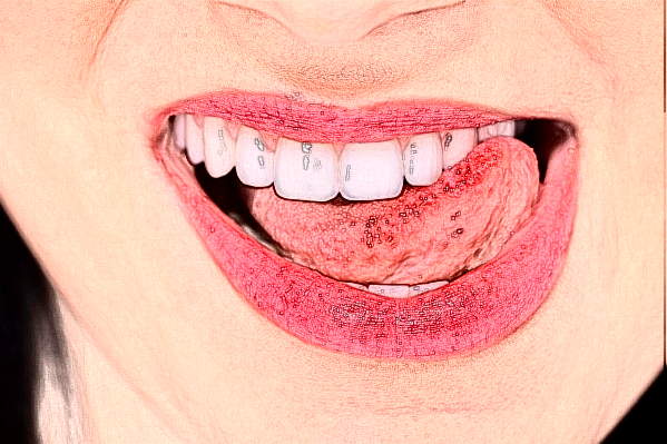 2024天津市第三中心醫(yī)院口腔科牙齒排列畸形矯治價目表(價格表)怎么樣