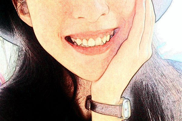 2024天津醫(yī)科大學總醫(yī)院口腔科種植牙修復怎么樣?全新案例分享