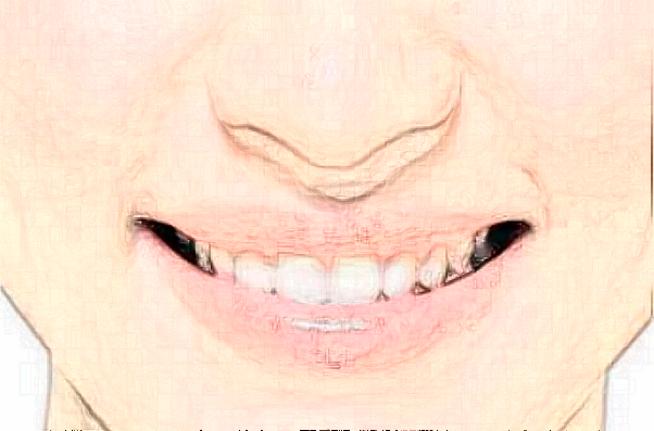 2024齊齊哈爾市中醫(yī)院根管怎么樣_誰做得好