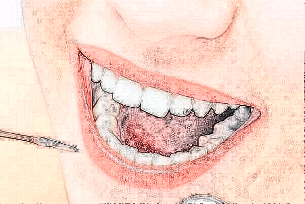 齊齊哈爾市中醫(yī)院全口義齒修復(fù)怎么樣_誰做得好