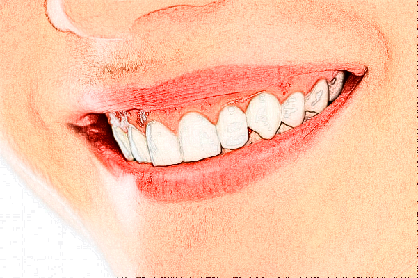 2024懷化市第一人民醫(yī)院拔智齒多少錢?拔智齒注意事項(xiàng)