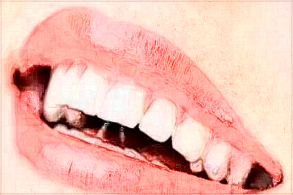 2024?？谑腥嗣襻t(yī)院補(bǔ)牙縫收費(fèi)標(biāo)準(zhǔn)?補(bǔ)牙醫(yī)生