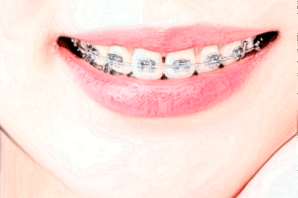 2024株洲市中心醫(yī)院口腔科收費?口腔科比較好的醫(yī)生