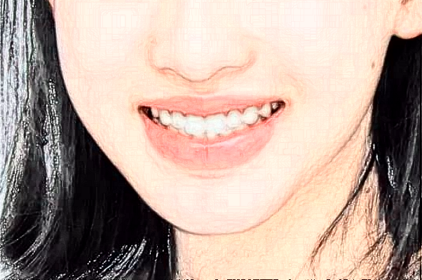 山東省千佛山醫(yī)院正畸怎么樣?2024正畸收費價格