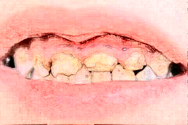 2024襄陽新德恩口腔門診部隱形矯正怎么樣_誰做得好