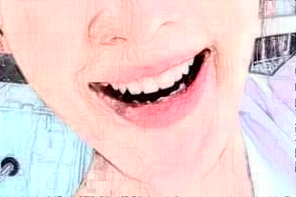 2024襄陽新德恩口腔門診部隱形矯正怎么樣_誰做得好