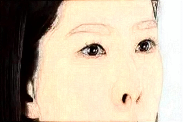 2024徐州醫(yī)科大學(xué)附屬醫(yī)院激光祛斑怎么樣_醫(yī)生介紹