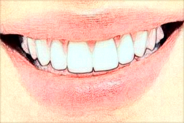 2024齊齊哈爾市中醫(yī)院牙齒畸形矯正怎么樣_整形日記分享