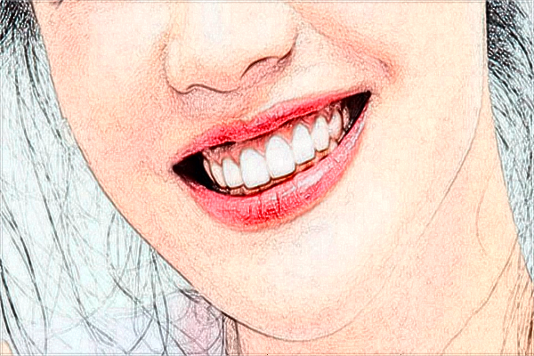 2024江蘇省人民醫(yī)院瓷貼面怎么樣?哪個醫(yī)生做的比較好