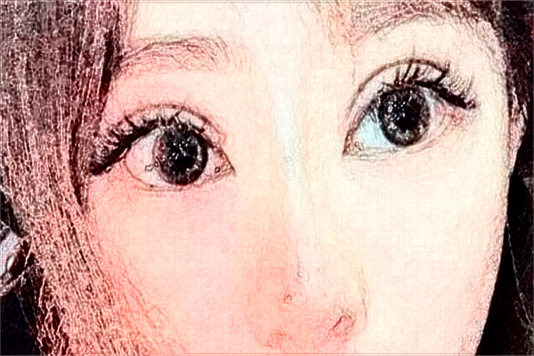 徐州醫(yī)科大學(xué)附屬醫(yī)院去眼袋做的好嗎?哪位醫(yī)生做得好