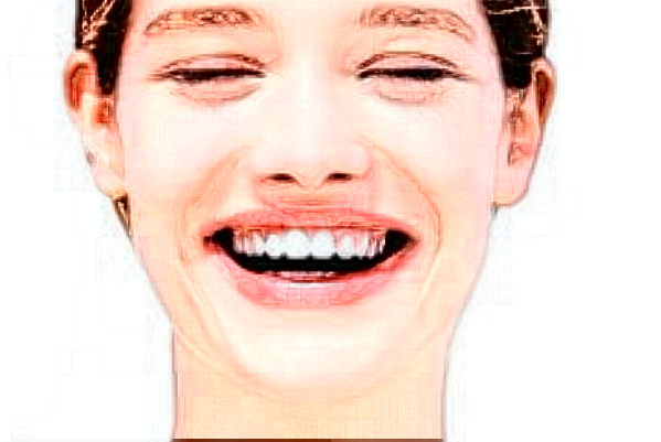 上海華美醫(yī)療美容醫(yī)院瓷貼面好嗎_真實(shí)案例發(fā)布