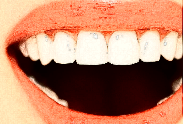 2024鄭州唯美口腔醫(yī)院烤瓷牙怎么樣【烤瓷牙案例分享】