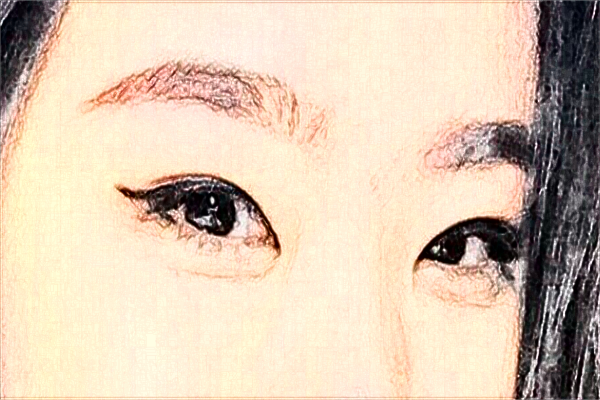 2024煙臺(tái)毓璜頂醫(yī)院整形價(jià)目表?附割雙眼皮案例