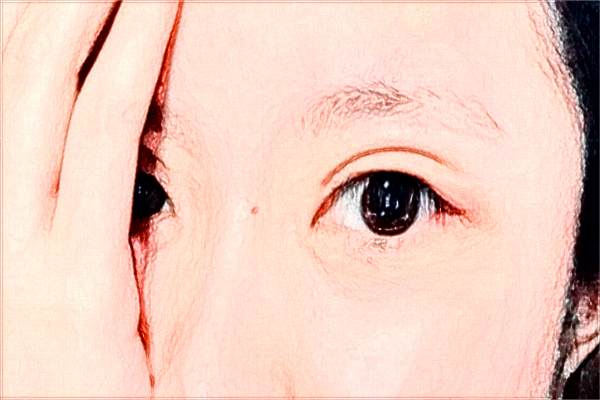 煙臺毓璜頂醫(yī)院熱瑪吉好嗎?2024熱瑪吉收費(fèi)價格