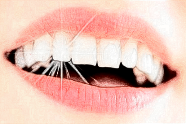 2024海口市人民醫(yī)院拔智齒多少錢?拔智齒有風(fēng)險(xiǎn)嗎