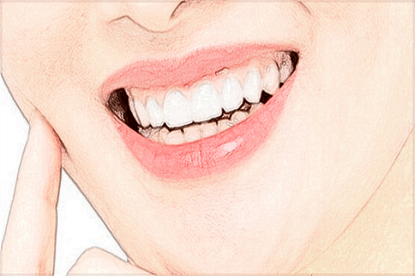 2024海口市人民醫(yī)院矯正牙齒的費(fèi)用?矯正牙齒的步驟