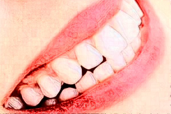 2024長沙好大夫口腔醫(yī)院鑲牙多少錢?做的怎么樣