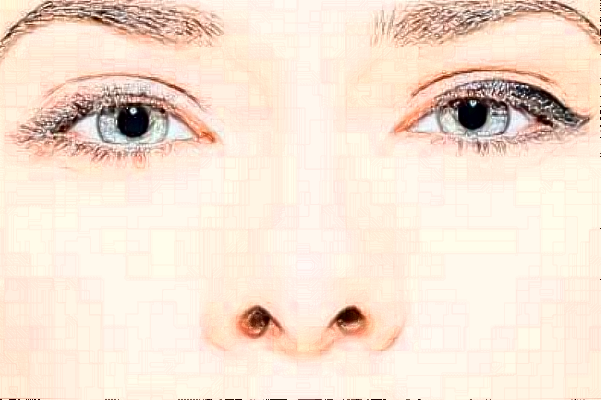 2024徐州醫(yī)科大學(xué)附屬醫(yī)院隆鼻多少錢_醫(yī)生名單推薦