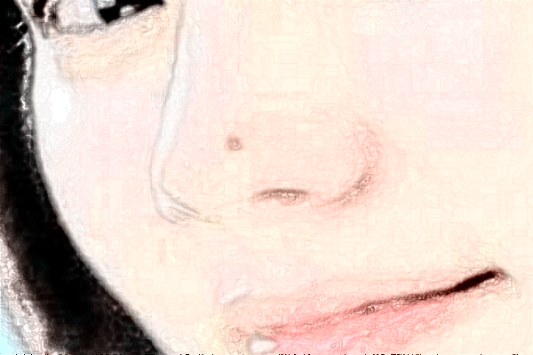 2024沈陽盛京醫(yī)院去痣好不好?體驗日記反饋