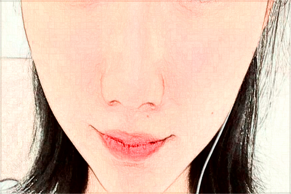 煙臺中醫(yī)院光子嫩膚好不好?2024光子嫩膚收費(fèi)價格